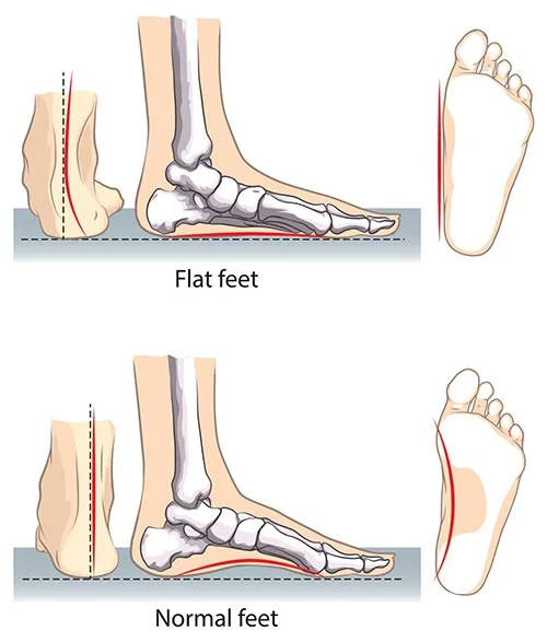 Flat 2025 footed people